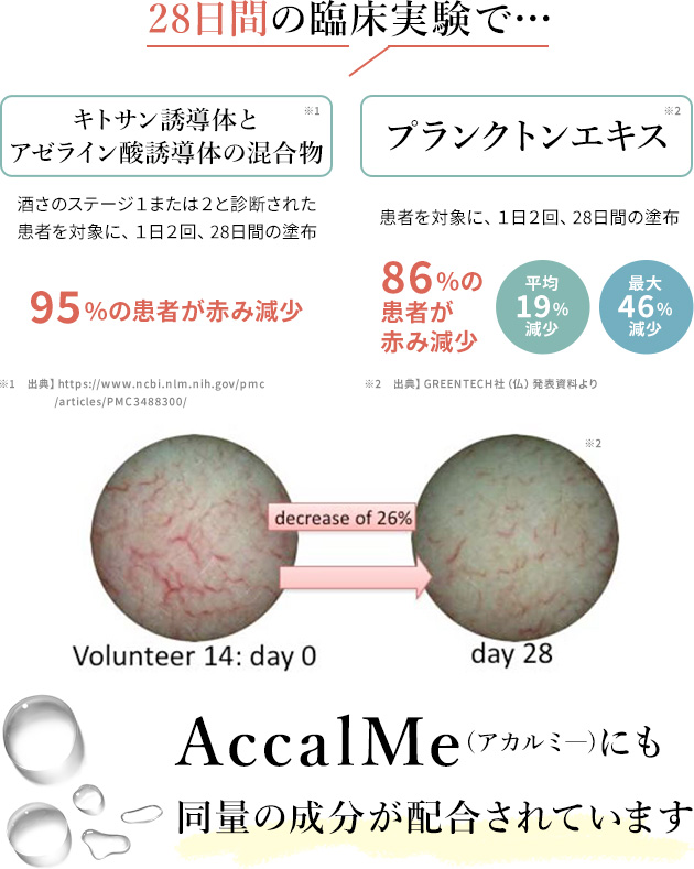 28日間の臨床実験で…キトサン誘導体95%の患者が赤み減少_プランクトンエキス86%の患者が赤み減少_AccalMe(アカルミー)にも同量の成分を配合しています。